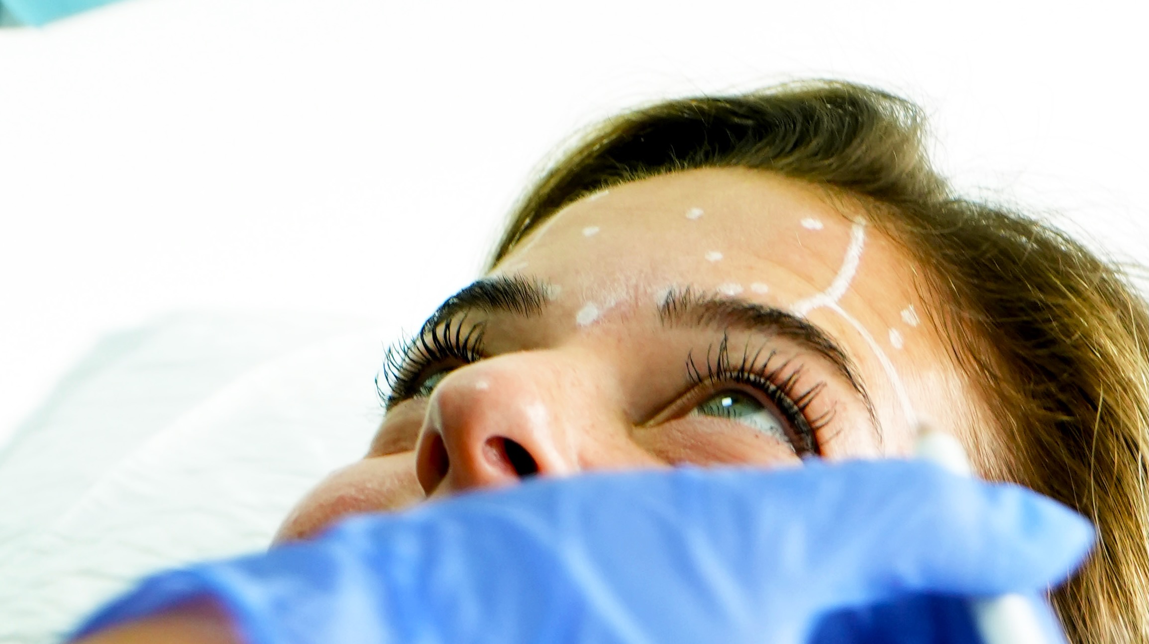 Harmonização facial