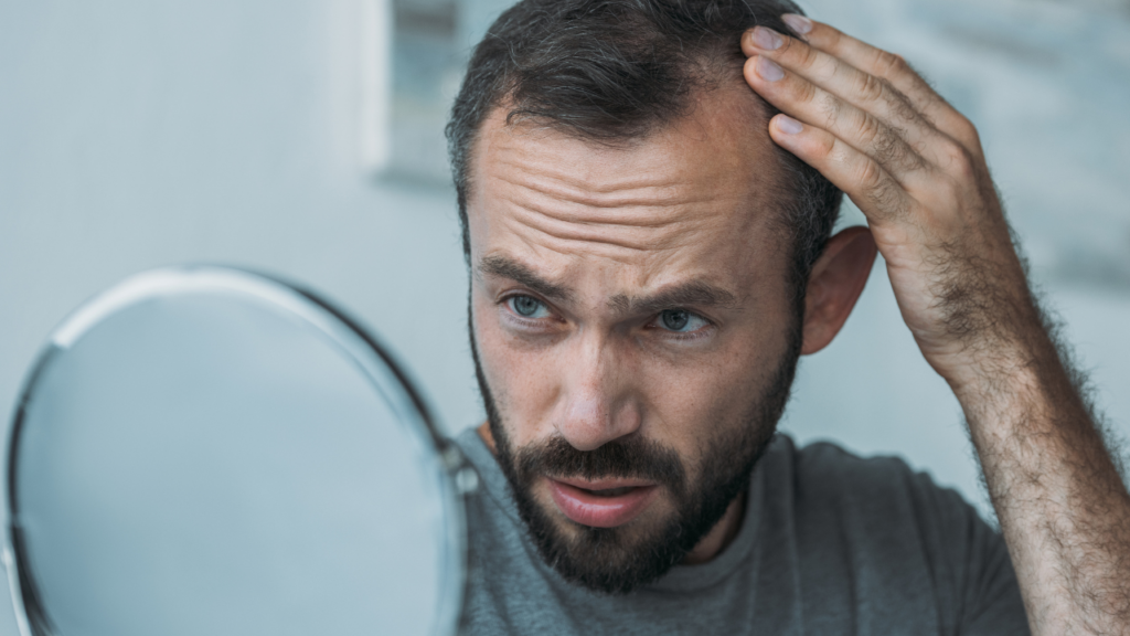 Hair Transplantation: All About the Procedure