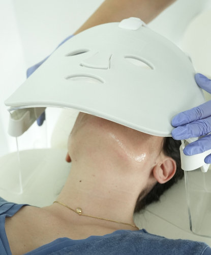 Peeling químico com Terapia Fotobiodinâmica